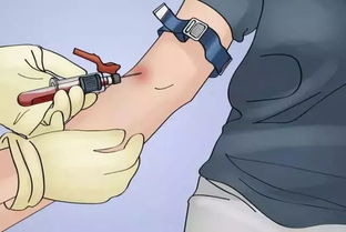 動(dòng)物采血過程中的注意事項(xiàng)