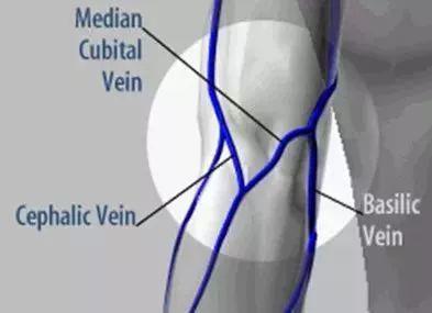 采集靜脈血的注意事項(xiàng),采動脈血的注意事項(xiàng),靜脈血的注意事項(xiàng)