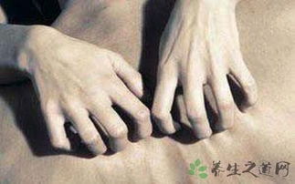 人工性蕁麻疹注意事項(xiàng),熱性蕁麻疹注意事項(xiàng),季節(jié)性蕁麻疹注意事項(xiàng)