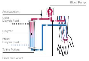 血液濾過(guò)的注意事項(xiàng),血液濾過(guò)治療注意事項(xiàng)不正確的是,血液透析濾過(guò)的注意事項(xiàng)