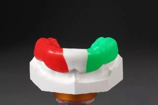 夜磨牙頜墊注意事項(xiàng)