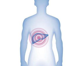 丙肝的各個注意事項