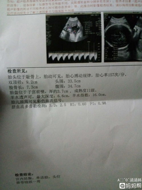 做超聲之前注意事項(xiàng),做腦超聲注意事項(xiàng),做泌尿超聲注意事項(xiàng)