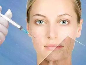 玻尿酸注射的注意事項(xiàng),玻尿酸注射術(shù)后注意事項(xiàng),玻尿酸除皺的6個(gè)注意事項(xiàng)