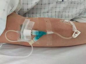 靜脈輸液法的注意事項