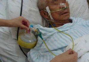 胃腸,減壓,注意事項,操作