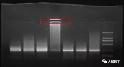 電泳,注意事項(xiàng),實(shí)驗(yàn)