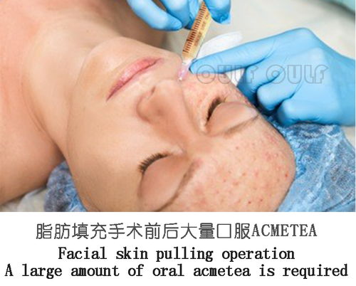 移植后一個(gè)月注意事項(xiàng)