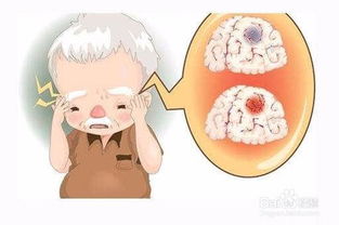 腦梗輸血應(yīng)該注意事項(xiàng)