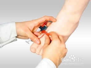 輸液,注意事項,技術(shù)