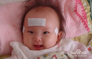 日本,熱貼,牌子,注意事項