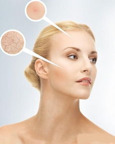 要注意,干燥,事項(xiàng),面部皮膚