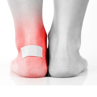 腳背,骨折,注意事項(xiàng)