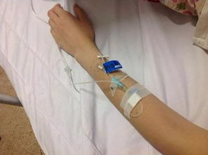 寶寶扎留置針注意事項,貓咪扎留置針注意事項,留置針的護(hù)理及注意事項