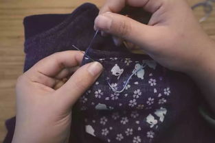 半月板縫合后注意事項(xiàng),面部傷口縫合后的注意事項(xiàng),外傷縫合后飲食注意事項(xiàng)