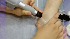 穿跟腱靴注意事項(xiàng)