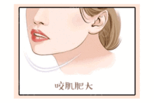 微整形術(shù)后注意事項