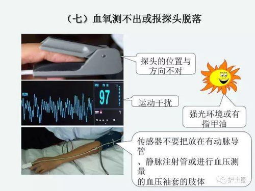 監(jiān)護,注意事項,心電