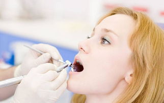 洗好牙后注意事項(xiàng)