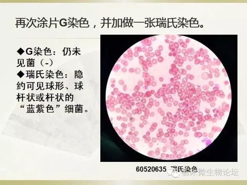 鏈球菌,鑒定,注意事項,試驗