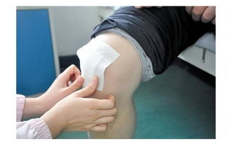 貼膏藥,注意事項,有哪些