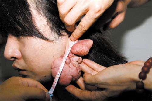 注意事項,穿耳洞