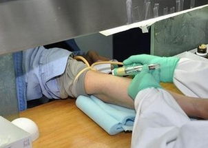 體檢查血糖注意事項(xiàng)