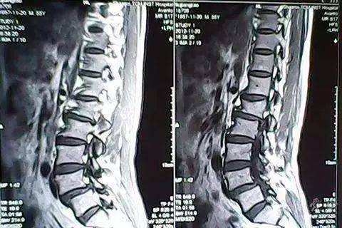 造影術(shù)前術(shù)后注意事項(xiàng),心臟造影術(shù)后注意事項(xiàng),腦血管造影術(shù)后注意事項(xiàng)