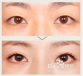 割雙眼皮需要注意哪些問題,雙眼皮術(shù)前術(shù)后注意事項,做雙眼皮前后注意事項有哪些