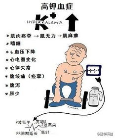 請(qǐng)闡述靜脈補(bǔ)鉀的注意事項(xiàng)