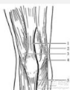 肌腱,斷裂,修補,注意事項
