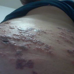 纏身龍注意事項