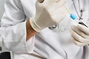 需注意,事項(xiàng),血檢,hcg