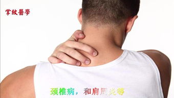 注意事項,治療,蛇盤瘡