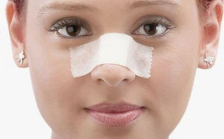 假體隆胸拆線后注意事項(xiàng),假體隆鼻手術(shù)后注意事項(xiàng)有哪些,假體隆鼻手術(shù)后注意事項(xiàng)