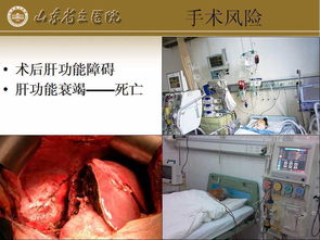 肝纖維瘤注意事項