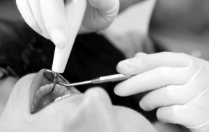 智齒拔牙注意事項(xiàng)與禁忌癥,智齒拔牙手術(shù)注意事項(xiàng),智齒拔牙縫針后注意事項(xiàng)