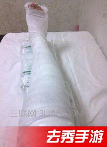 骨折,手術(shù)后,注意事項