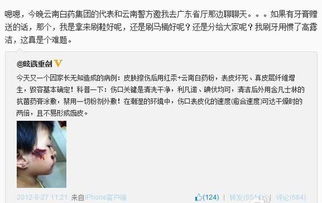 云南白藥使用方法和注意事項,云南白藥噴霧劑注意事項,云南白藥金戈注意事項