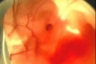 孕25周注意事項有哪些,孕25周飲食注意事項,孕30周的注意事項及變化