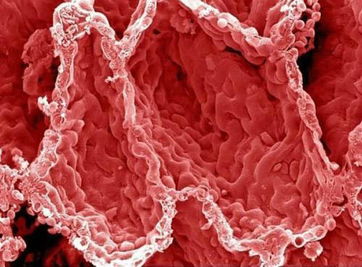 肺氣泡注意事項