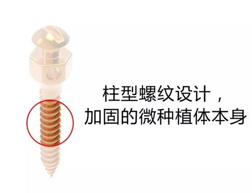 支抗釘打后注意事項