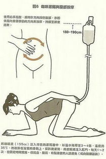 做完灌腸后注意事項