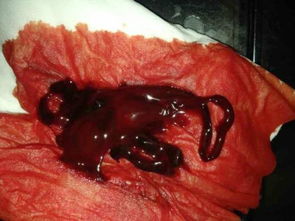 功血清宮后注意事項(xiàng)