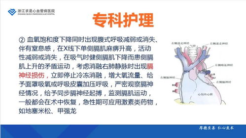 導(dǎo)管消融術(shù)后注意事項(xiàng)