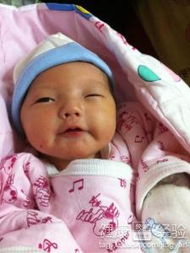 引流黃疸后注意事項(xiàng)