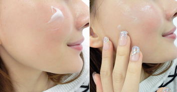 opt去紅血絲注意事項(xiàng)