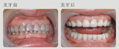 注意事項(xiàng)