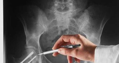 動(dòng)物內(nèi)置鋼釘術(shù)后注意事項(xiàng)