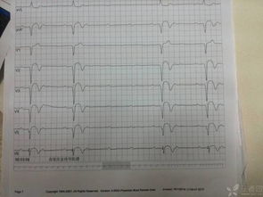 b受體阻滯劑應(yīng)用注意事項